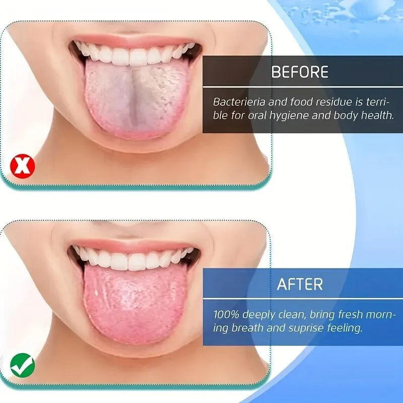 U-Shaped Steel Tongue Scraper for Ultimate Freshness